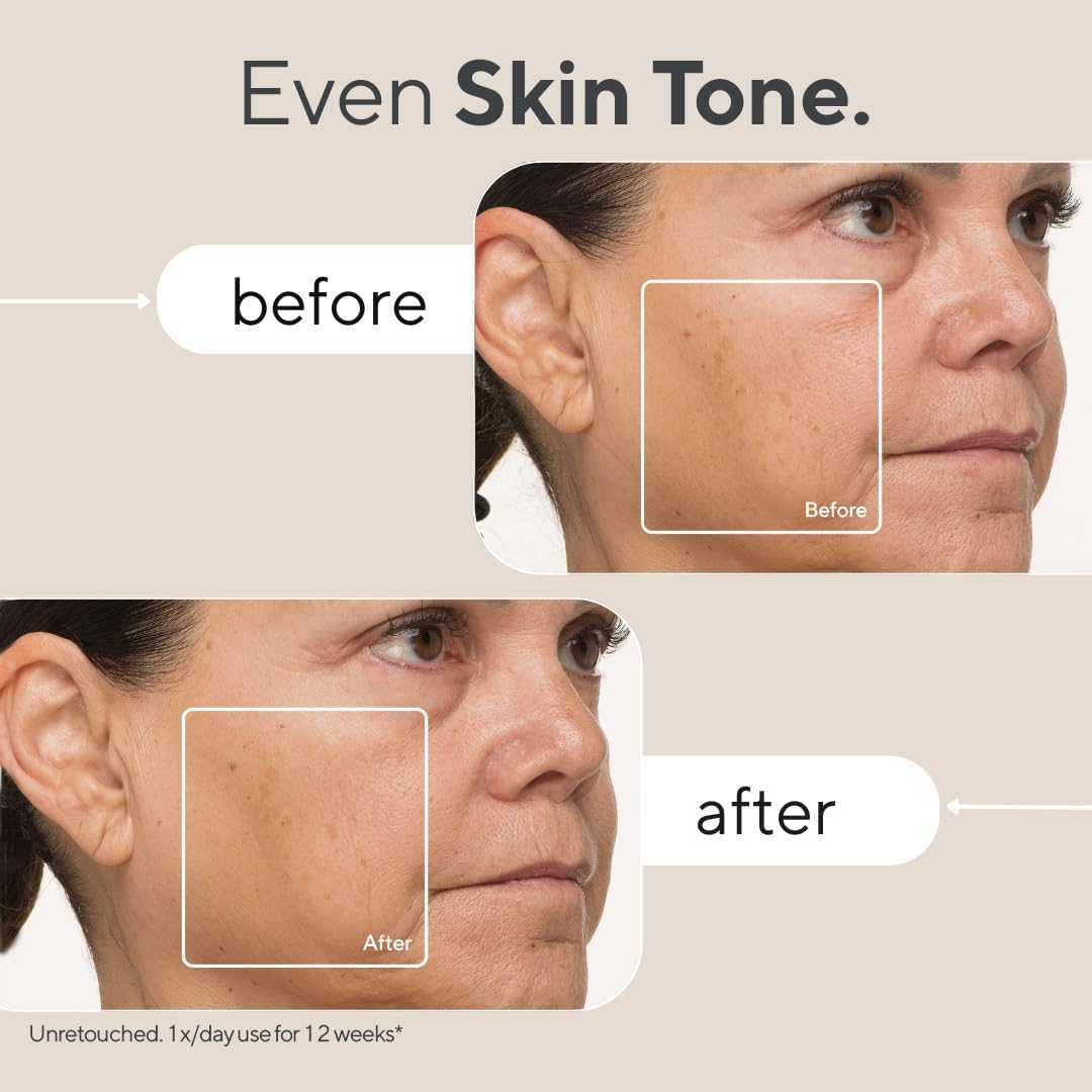 TheraFace Skin Care Mask Light IR Therapy